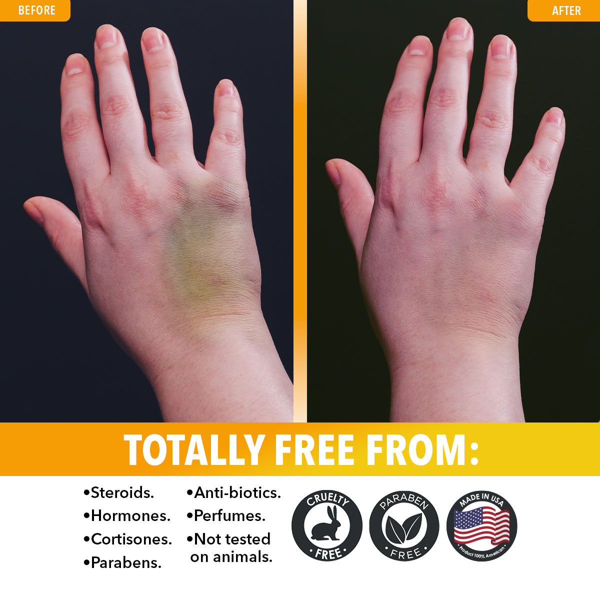 Arnica Gel