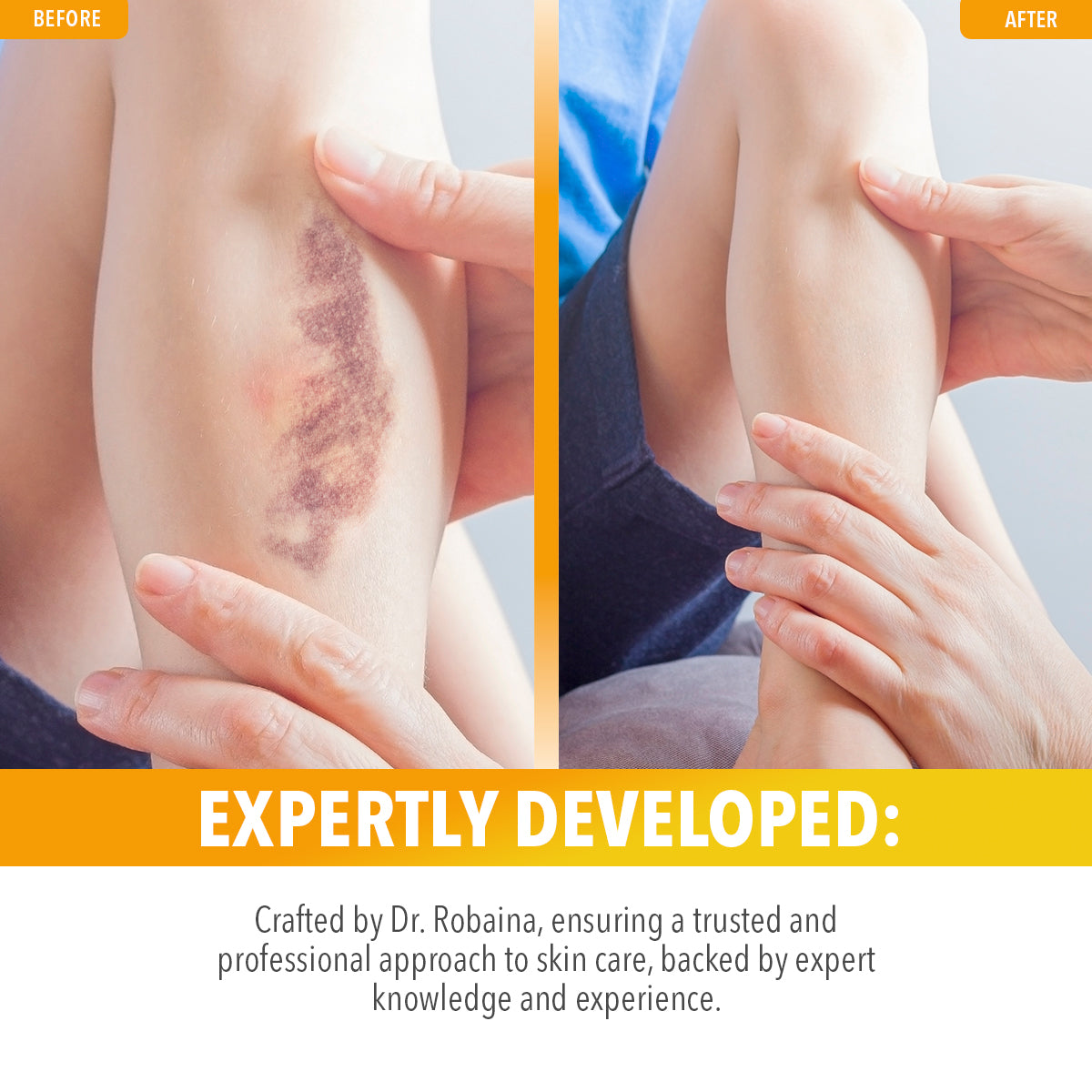Arnica Gel