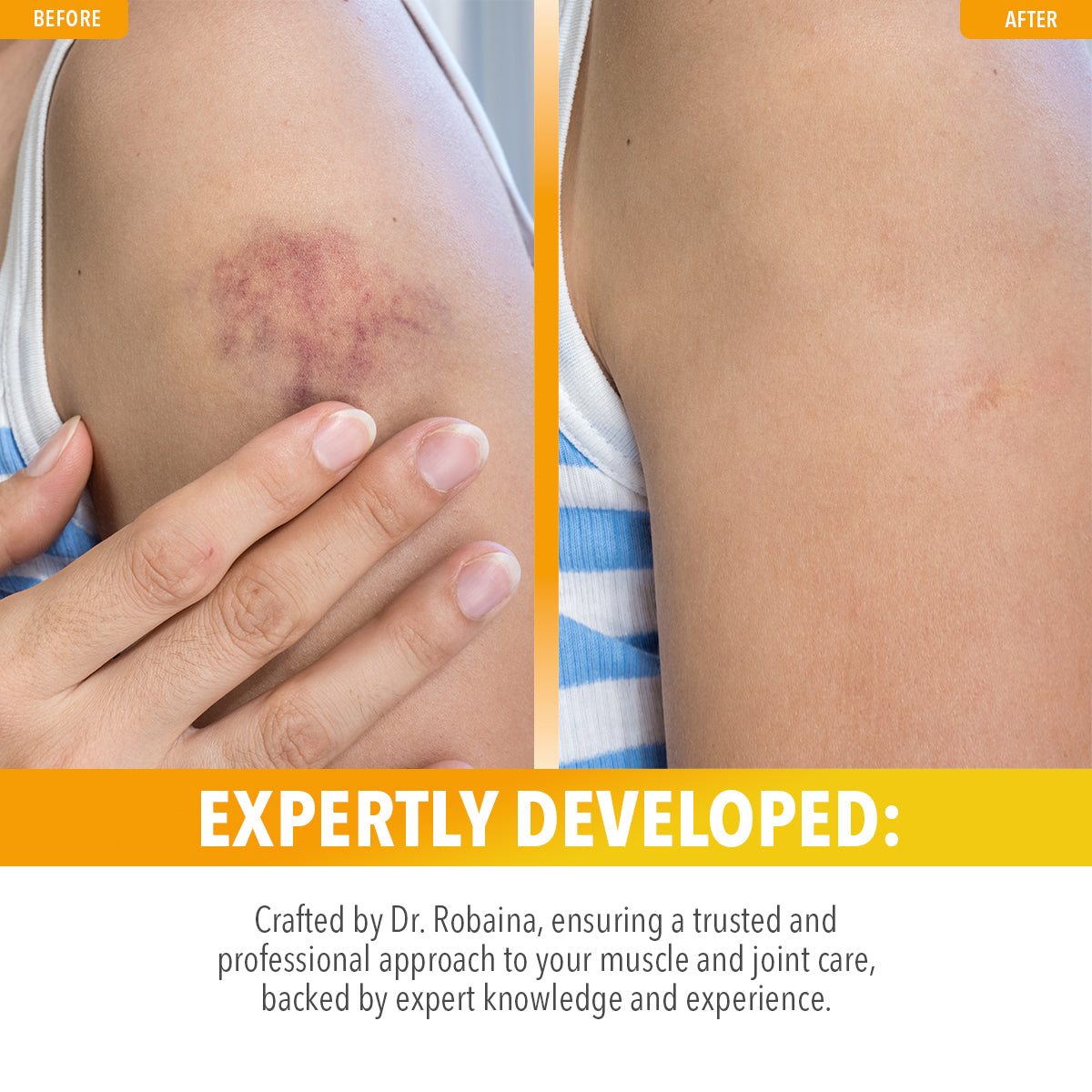 Arnica Roll-on