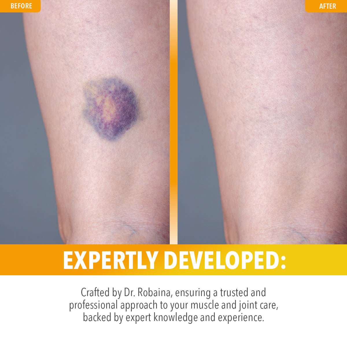 Arnica Salve