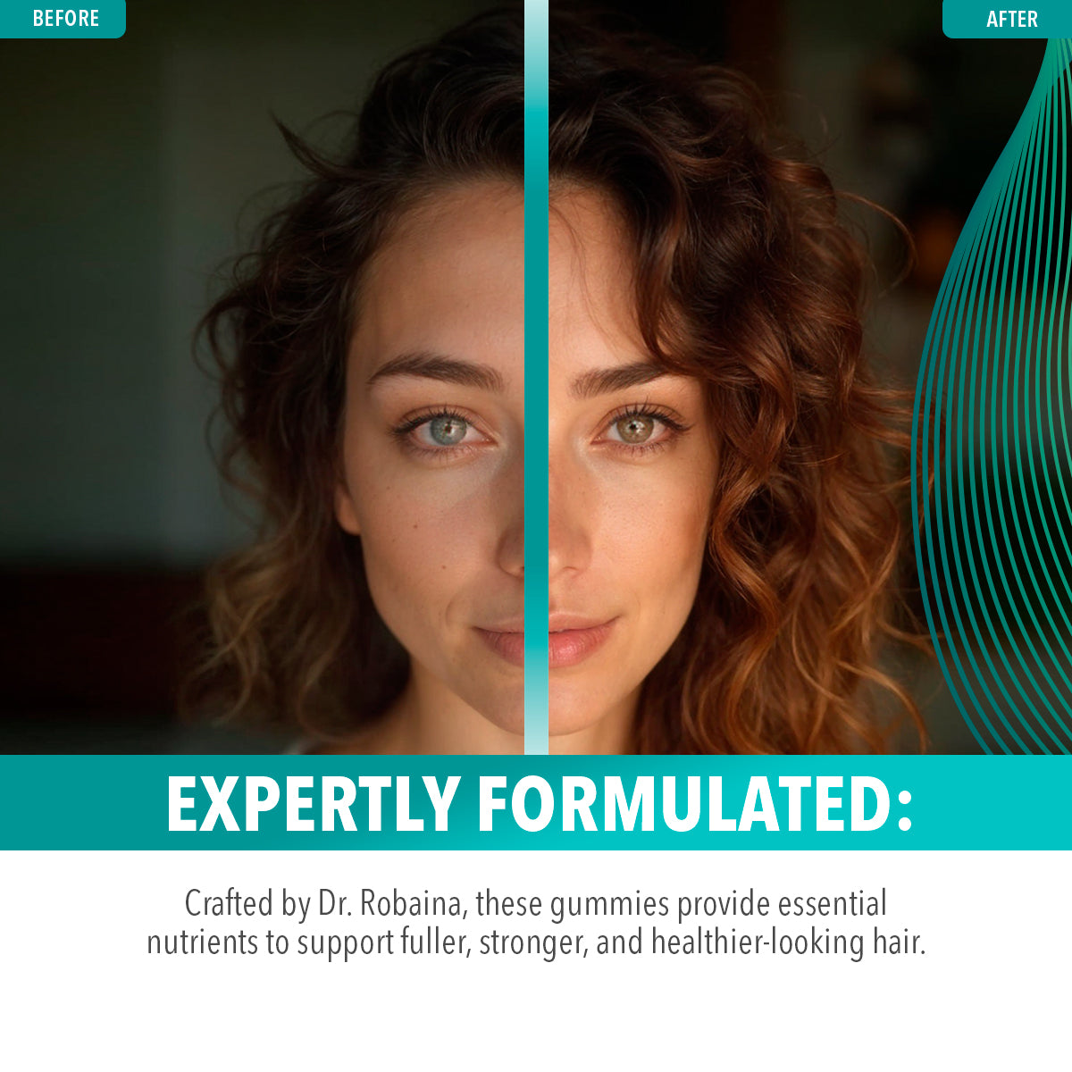 Dr. Robaina Intensive Hair Growth Gummies | Fuller-Looking Hair | Healthier Hair Appearance | Stronger Hair | Made in USA