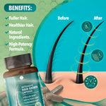 Thumbnail 2 of 9, Dr. Robaina Intensive Hair Growth Capsules with Biotin & Keratin - For Fuller, Thicker Hair (60 Capsules)