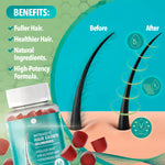 Thumbnail 2 of 9, Dr. Robaina Intensive Hair Growth Gummies with Biotin & Keratin - For Stronger, Fuller Hair (60 Gummies)