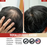 Thumbnail 5 of 9, Dr. Robaina 100% Pure Organic Castor Oil - Cold Pressed for Hair, Lashes & Brows (2 fl oz)